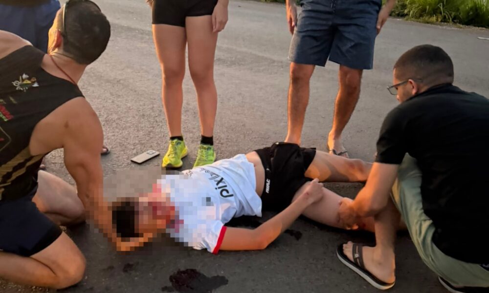 Adolescente é entubado após ser atropelado na BR-364 em Sena Madureira